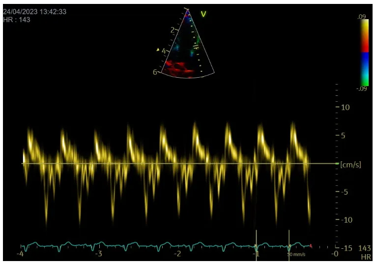 Tissue doppler image courtesy of Dave Dickson at Heart Vets