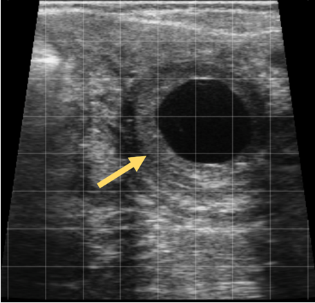 Ultrasonographybovineovary8